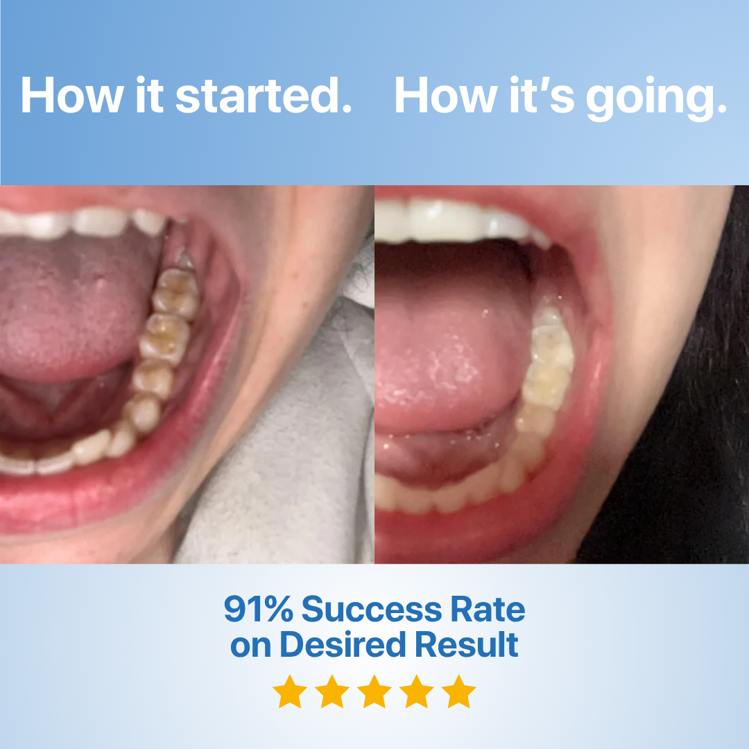 Shinzra Fluoride-Free Hydroxyapatite Tooth Armor Essence & Enamel Repair