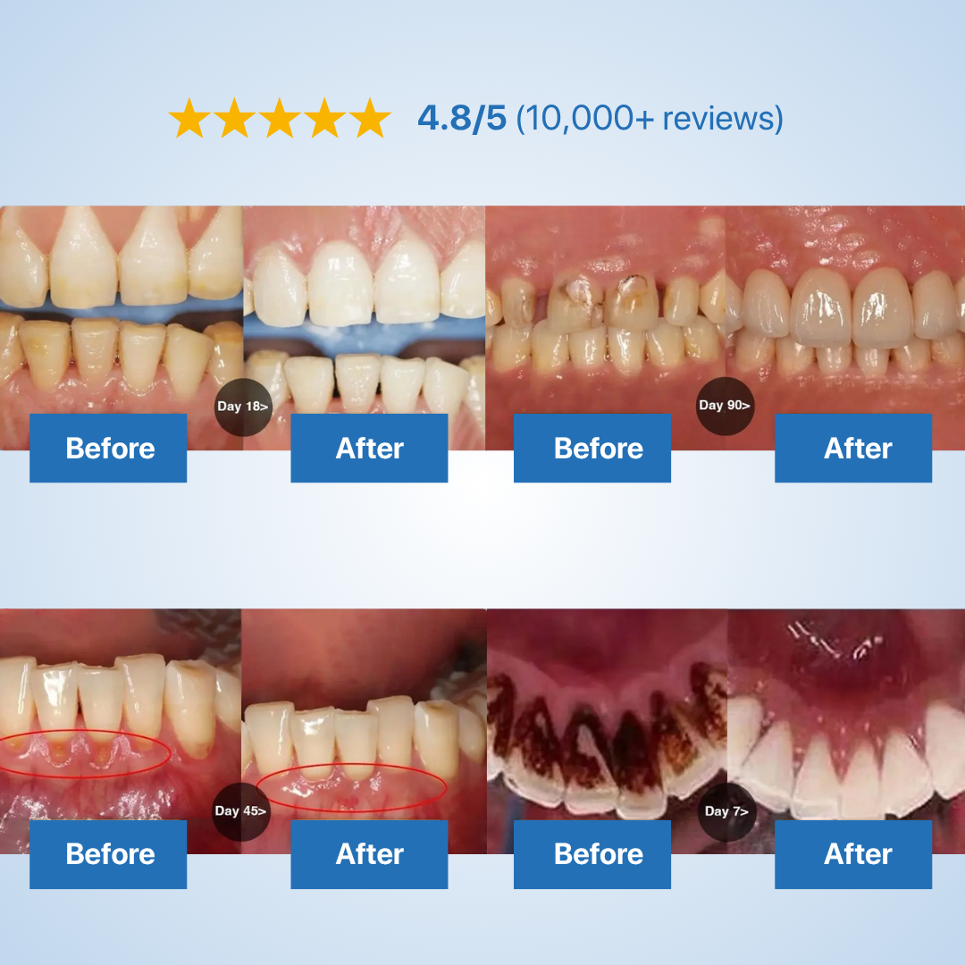 Shinzra Tooth Repairing Powder