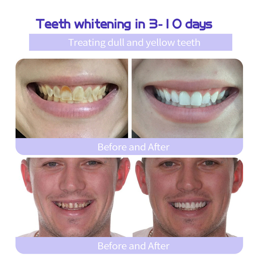 Shinzra Teeth Restoration Mineral Powder — Total Oral Restoration