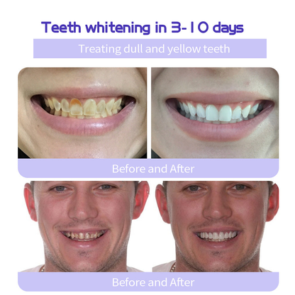 Shinzra Teeth Restoration Mineral Powder — Total Oral Restoration