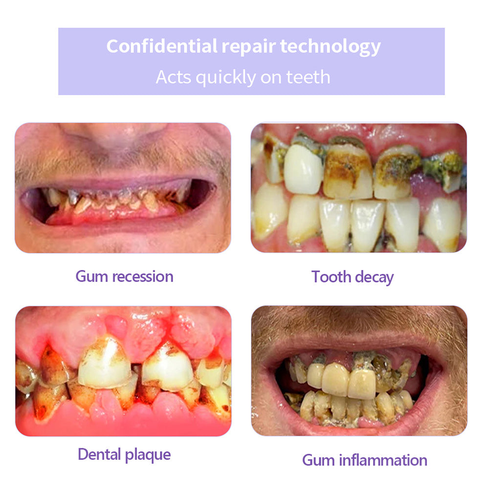 Shinzra Teeth Restoration Mineral Powder — Total Oral Restoration