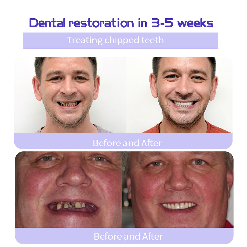 Shinzra Teeth Restoration Mineral Powder — Total Oral Restoration