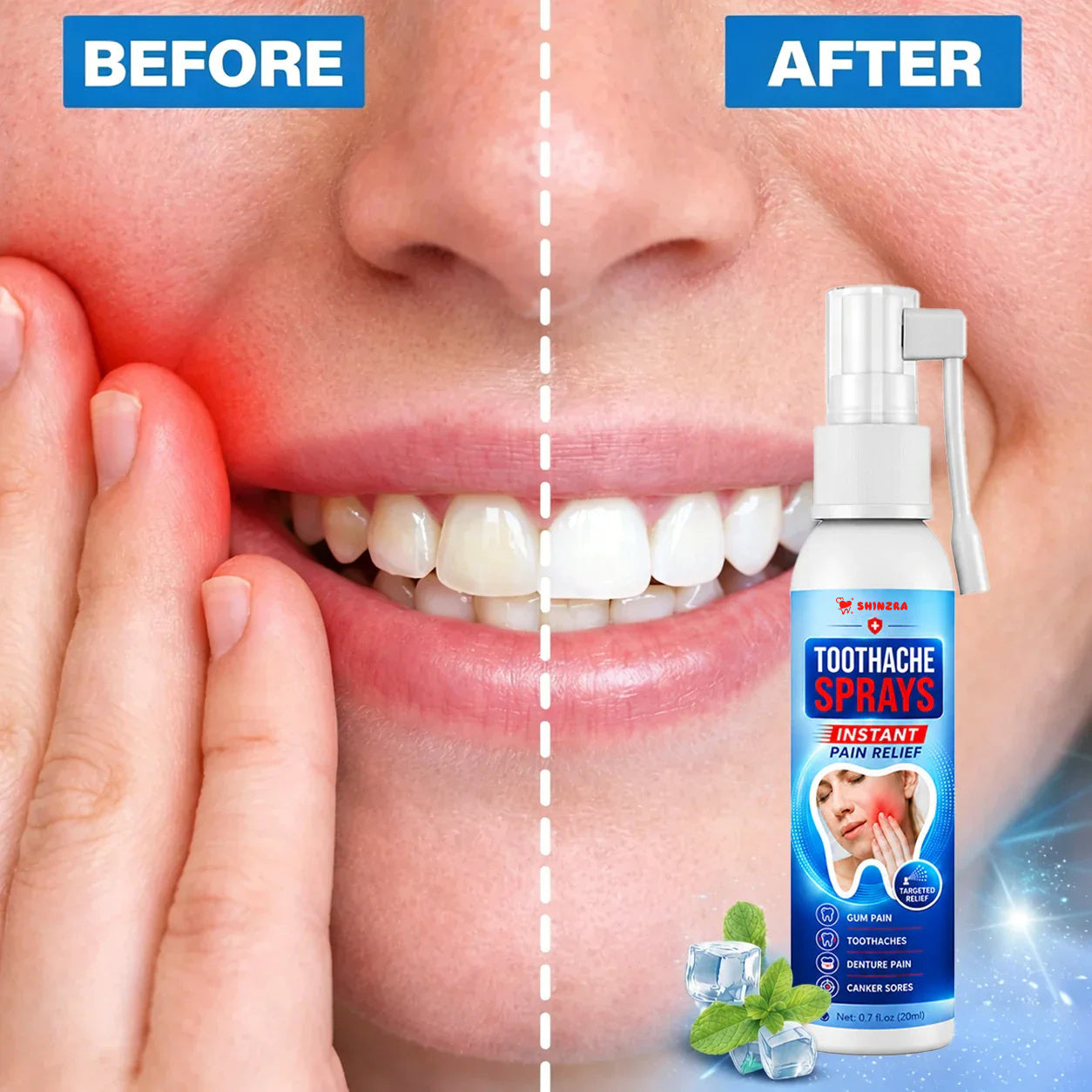 Shinzra Soothing Oral Spray | Fast-Acting Comfort for Tooth & Gum Discomfort