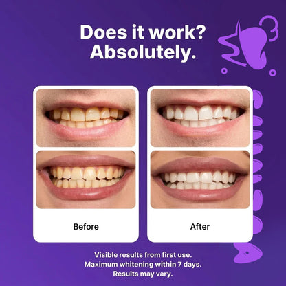 Shinzra Purple  Teeth Whitening Strips